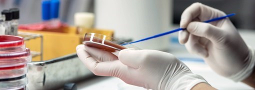 תרבית דם (Blood Culture) - תמונה